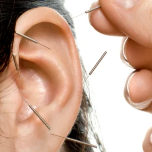 Acupuncture on ear for addiction treatment